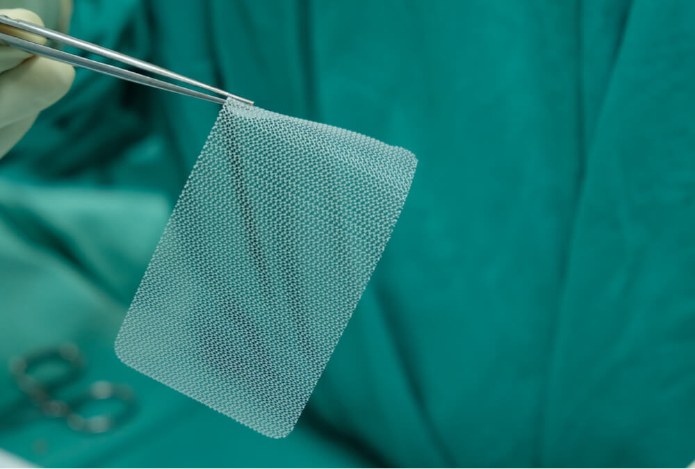 Surgical mesh