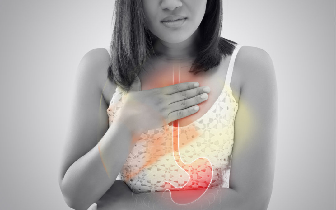 How to Tell if You Have Heartburn, Acid Reflux or GERD