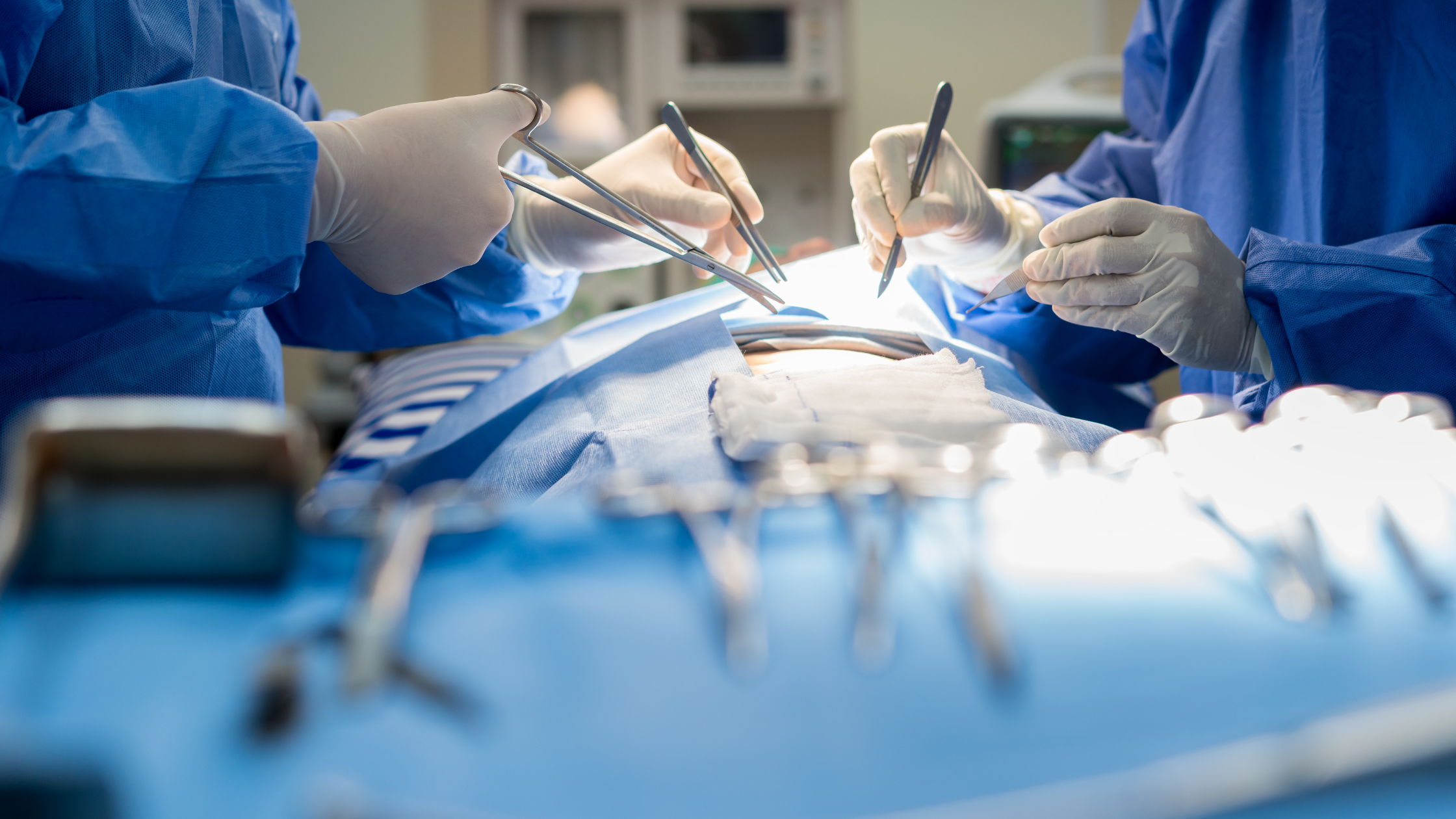 surgeons performing a splenectomy